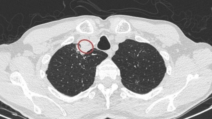 উদ্ভিদ ছত্রাকজনিত রোগ