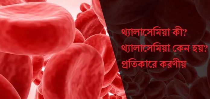 থ্যালাসেমিয়া