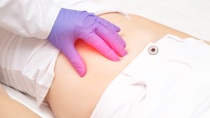 অ্যাপেন্ডিসাইটিস