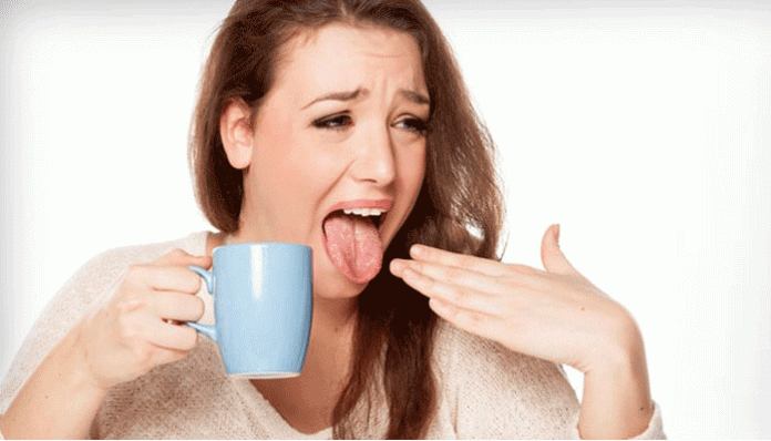 গরমে জিহ্বা পুড়লে কী করবেন গরমে জিহ্বা পোড়া