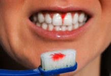 যে রোগে দাঁত কিংবা মাড়ি থেকে রক্ত পড়ে!