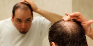 যেসব কারণে মাথায় দ্রুত টাক পড়ে