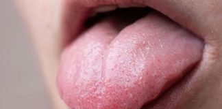 চিকিৎসকের কাছে গেলে আগে জিভ দেখাতে বলে কেন?