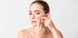 ব্রণ দূর করার ঘরোয়া উপায়