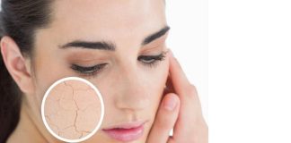 ক্রিম মাখলেও ত্বক ফেটে যাচ্ছে?