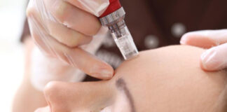 ‘ভ্যাম্পায়ার ফেশিয়াল’ করে বড় বিপদে ৩ নারী