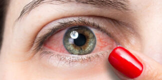 চোখ লাল হওয়ার কারণ কী? জানুন সমাধান