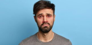 জন্ডিস ছাড়াও যে ৫ কারণে চোখ হলুদ হতে পারে