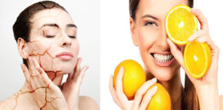 ভিটামিন সি অভাবের শরীরে দেখা দেয় ৭ সমস্যা