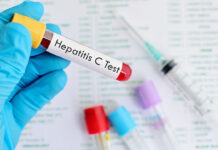 বিশ্বে হেপাটাইটিস সি রোগীর সংখ্যায় শীর্ষে পাকিস্তান