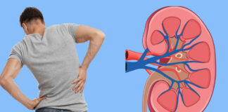 পিঠে-কোমরে ব্যথাও হতে পারে কিডনি রোগের লক্ষণ