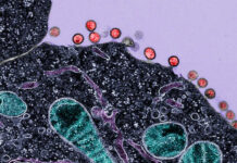 এইডস চিকিৎসায় আশার আলো, ১৮ মাস ওষুধ না খেয়েও সুস্থ ৭ রোগী