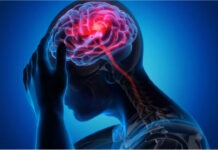 শীতে বাড়ে স্ট্রোকের ঝুঁকি, আক্রান্ত হলে বুঝবেন কীভাবে?